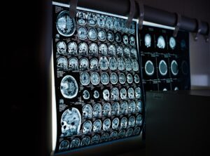 questism void scans